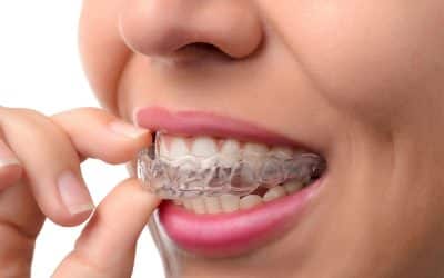 A Patient’s Guide to Invisalign: What to Expect from Start to Finish