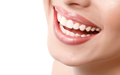 Implant Retained Lower Dentures Explained: Watch How They Transform Your Smile