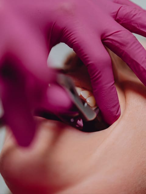 Dentist wearing burgundy gloves doing a dental examination to patient