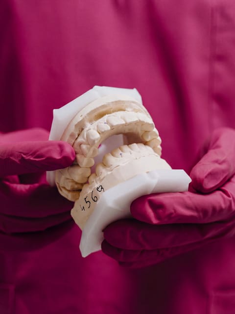 Dentist handling denture mould